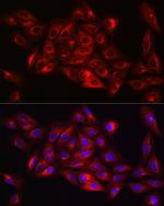 alpha Tubulin Antibody in Immunocytochemistry (ICC/IF)