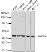 Septin 2 Recombinant Rabbit Monoclonal Antibody (9N1B3)