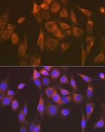 SEC23B Recombinant Rabbit Monoclonal Antibody (1D4R7)