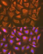 UAP1 Recombinant Rabbit Monoclonal Antibody (5S7M2)