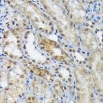 eIF2b epsilon Antibody in Immunohistochemistry (Paraffin) (IHC (P))