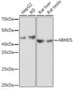 ABHD5 Recombinant Rabbit Monoclonal Antibody (2K8W9)