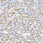 NDUFS4 Antibody in Immunohistochemistry (Paraffin) (IHC (P))
