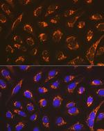 DIABLO Antibody in Immunocytochemistry (ICC/IF)