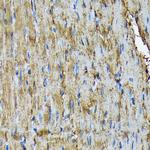HSP20 Antibody in Immunohistochemistry (Paraffin) (IHC (P))