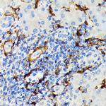 HSP20 Antibody in Immunohistochemistry (Paraffin) (IHC (P))