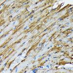 HSP20 Recombinant Rabbit Monoclonal Antibody (3J5N1)