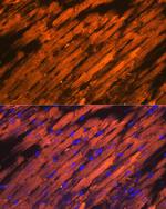 HSP20 Antibody in Immunohistochemistry (Paraffin) (IHC (P))