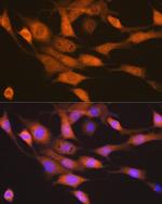 RPS6KB2 Recombinant Rabbit Monoclonal Antibody (5D8F5)