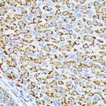 RPS6KB2 Antibody in Immunohistochemistry (Paraffin) (IHC (P))