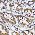 RPS6KB2 Antibody in Immunohistochemistry (Paraffin) (IHC (P))