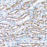 RPS6KB2 Antibody in Immunohistochemistry (Paraffin) (IHC (P))