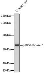 RPS6KB2 Antibody in Western Blot (WB)