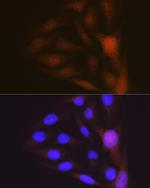 MSI1 Antibody in Immunocytochemistry (ICC/IF)