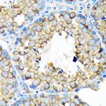 ALDH1A2 Recombinant Rabbit Monoclonal Antibody (3D2P3)