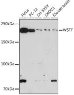 BAZ1B Recombinant Rabbit Monoclonal Antibody (10Y9B6)
