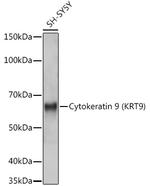 KRT9 Recombinant Rabbit Monoclonal Antibody (9A5H3)