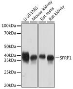SFRP1 Recombinant Rabbit Monoclonal Antibody (5I6V1)