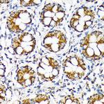 TOMM22 Recombinant Rabbit Monoclonal Antibody (6R1L7)