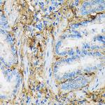 Collagen VI Antibody in Immunohistochemistry (Paraffin) (IHC (P))