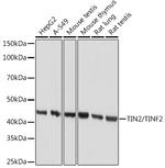 TIN2 Recombinant Rabbit Monoclonal Antibody (4W5P2)