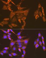 USP9X Recombinant Rabbit Monoclonal Antibody (7T0S2)