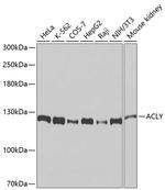 ATP Citrate Lyase Antibody in Western Blot (WB)