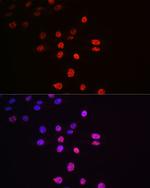 Phospho-p70 S6 Kinase (Thr421) Recombinant Rabbit Monoclonal Antibody (0Y3C7)