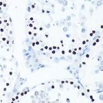 Phospho-Histone H2A.X (Ser139) Antibody in Immunohistochemistry (Paraffin) (IHC (P))