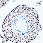 Phospho-Histone H2A.X (Ser139) Antibody in Immunohistochemistry (Paraffin) (IHC (P))