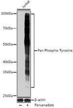 Phosphotyrosine Antibody in Western Blot (WB)