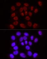 Phospho-POLR2A (Ser2) Antibody in Immunocytochemistry (ICC/IF)