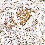 Phospho-POLR2A (Ser2) Antibody in Immunohistochemistry (Paraffin) (IHC (P))