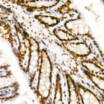 Phospho-POLR2A (Ser2) Antibody in Immunohistochemistry (Paraffin) (IHC (P))