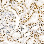 Phospho-POLR2A (Ser2) Antibody in Immunohistochemistry (Paraffin) (IHC (P))