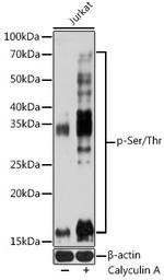 Phosphoserine/threonine Monoclonal Antibody (7A1P3)