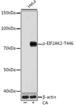 Phospho-PKR (Thr446) Recombinant Rabbit Monoclonal Antibody (5S9X7)