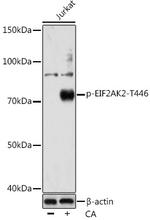 Phospho-PKR (Thr446) Antibody in Western Blot (WB)