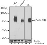 Phospho-Paxillin (Tyr118) Recombinant Rabbit Monoclonal Antibody (2E6P0)