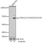 Phospho-PAK1/2/3 (Ser144) Recombinant Rabbit Monoclonal Antibody (1T7A5)