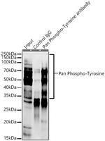 Phosphotyrosine Antibody in Immunoprecipitation (IP)