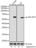 Phospho-AKT1/AKT2/AKT3 (Ser473) Recombinant Rabbit Monoclonal Antibody (2E3A3)