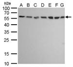 ATG12 Monoclonal Antibody (GT9411)