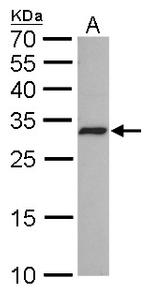 CDK4 Monoclonal Antibody (GT624)