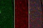 VASP Antibody in Immunohistochemistry (Paraffin) (IHC (P))