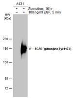 Phospho-EGFR (Tyr1173) Antibody in Western Blot (WB)