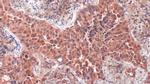 PGP9.5 Antibody in Immunohistochemistry (Paraffin) (IHC (P))