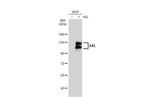 AXL Monoclonal Antibody (GT1174)