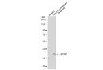 CTGF Monoclonal Antibody (GT8610)