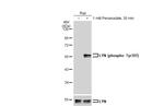 Phospho-Lyn (Tyr397) Recombinant Rabbit Monoclonal Antibody (HL122)